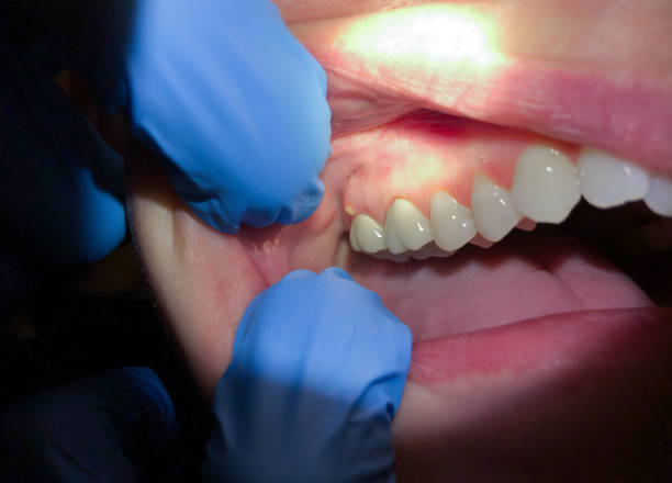Best Tooth Pain Emergency Relief  in Portage Lakes, OH