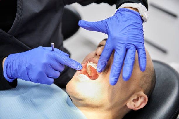 Best Knocked-Out Tooth Emergency  in Portage Lakes, OH