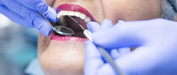 Best Cracked Tooth Emergency Dentist  in Portage Lakes, OH